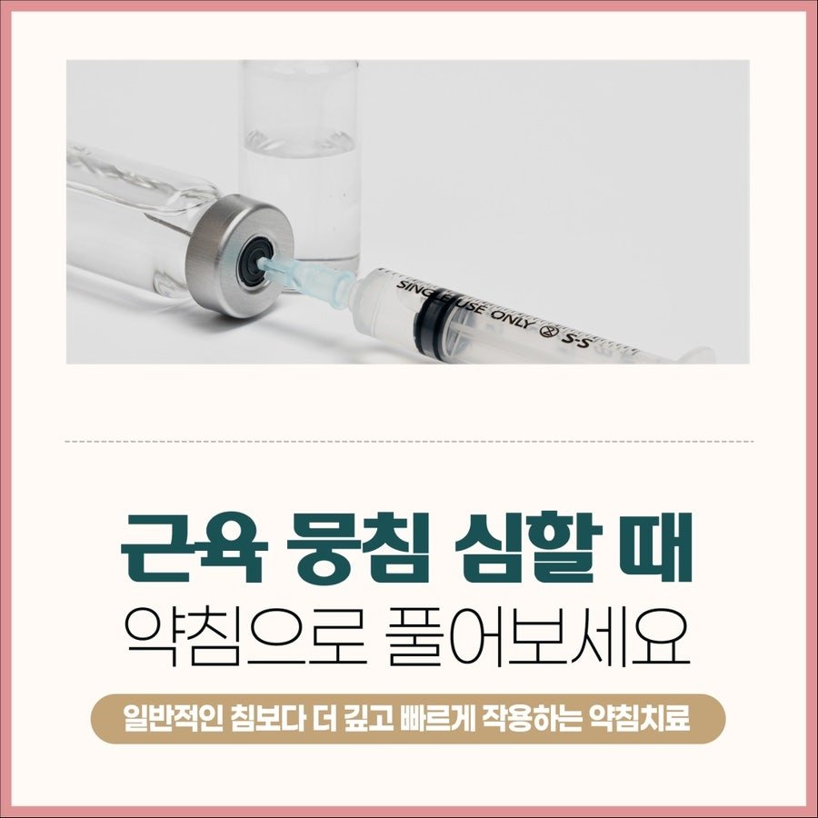 근육 뭉침 심할 때 약침으로 풀어보세요